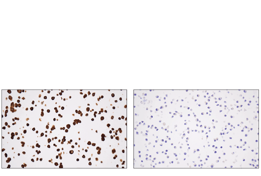 Immunohistochemistry Image 4: Tyrosine Hydroxylase (E2L6M) Rabbit mAb (BSA and Azide Free)