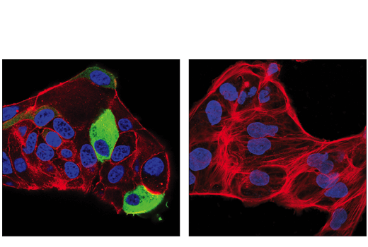 Immunofluorescence Image 2: Tyrosine Hydroxylase (E2L6M) Rabbit mAb (BSA and Azide Free)