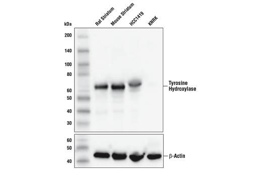 Western Blotting Image 1: Tyrosine Hydroxylase (E2L6M) Rabbit mAb (BSA and Azide Free)