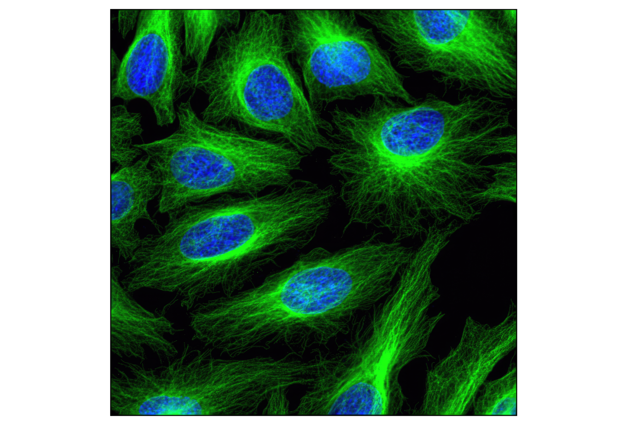Immunofluorescence Image 1: β-Tubulin (9F3) Rabbit mAb (BSA and Azide Free)