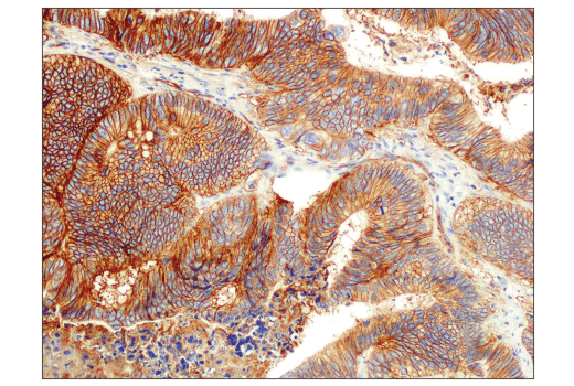 Immunohistochemistry Image 1: PVR/CD155 (D8A5G) Rabbit mAb