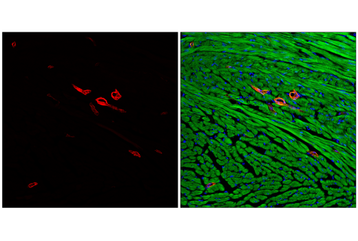 Immunofluorescence Image 1: α-Smooth Muscle Actin (D4K9N) XP® Rabbit mAb (Alexa Fluor® 700 Conjugate)