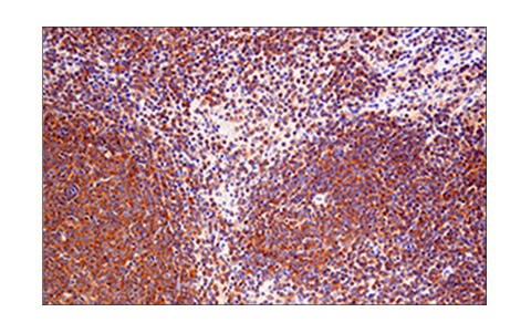 Immunohistochemistry Image 3: RIP (E8S7U) XP® Rabbit mAb (BSA and Azide Free)