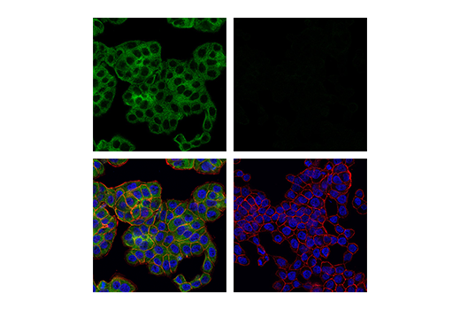 Immunofluorescence Image 1: RIP (E8S7U) XP® Rabbit mAb (BSA and Azide Free)