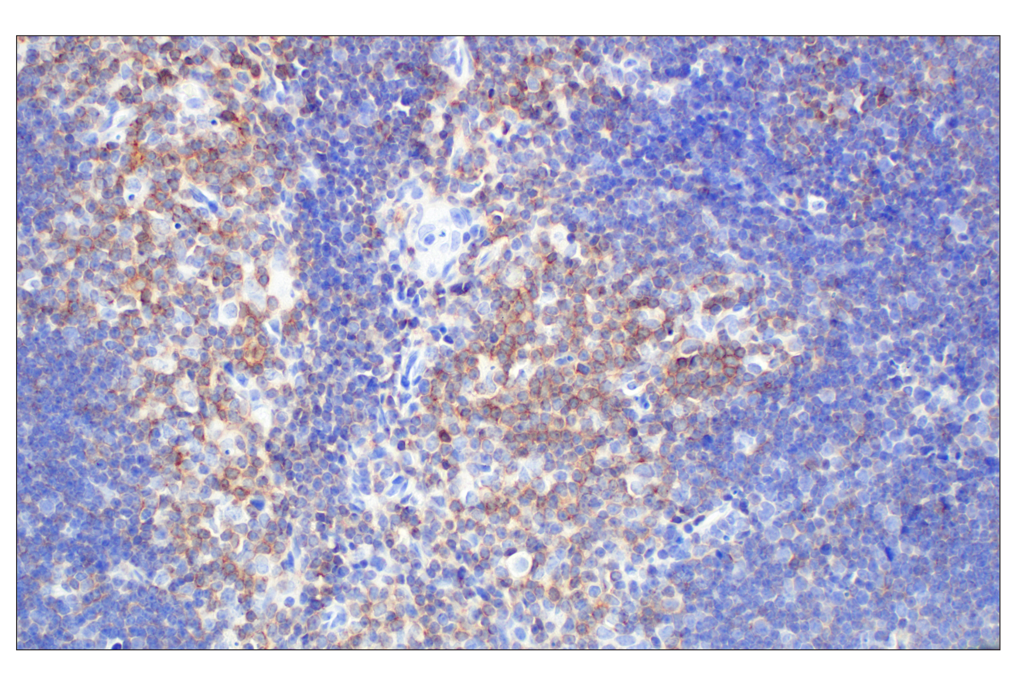 Immunohistochemistry Image 4: CD6 (E9Q1V) Rabbit mAb (BSA and Azide Free)