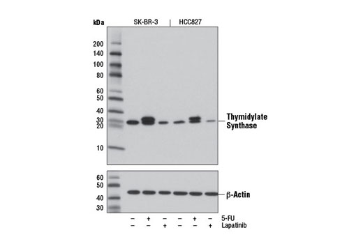 Western Blotting Image 1: Thymidylate Synthase (D5B3) XP® Rabbit mAb (BSA and Azide Free)