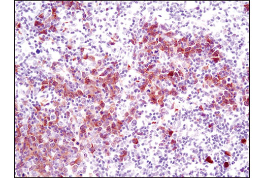 Immunohistochemistry Image 2: Thymidylate Synthase (D5B3) XP® Rabbit mAb (BSA and Azide Free)
