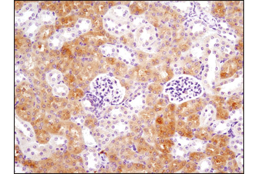 Immunohistochemistry Image 3: Thymidylate Synthase (D5B3) XP® Rabbit mAb (BSA and Azide Free)