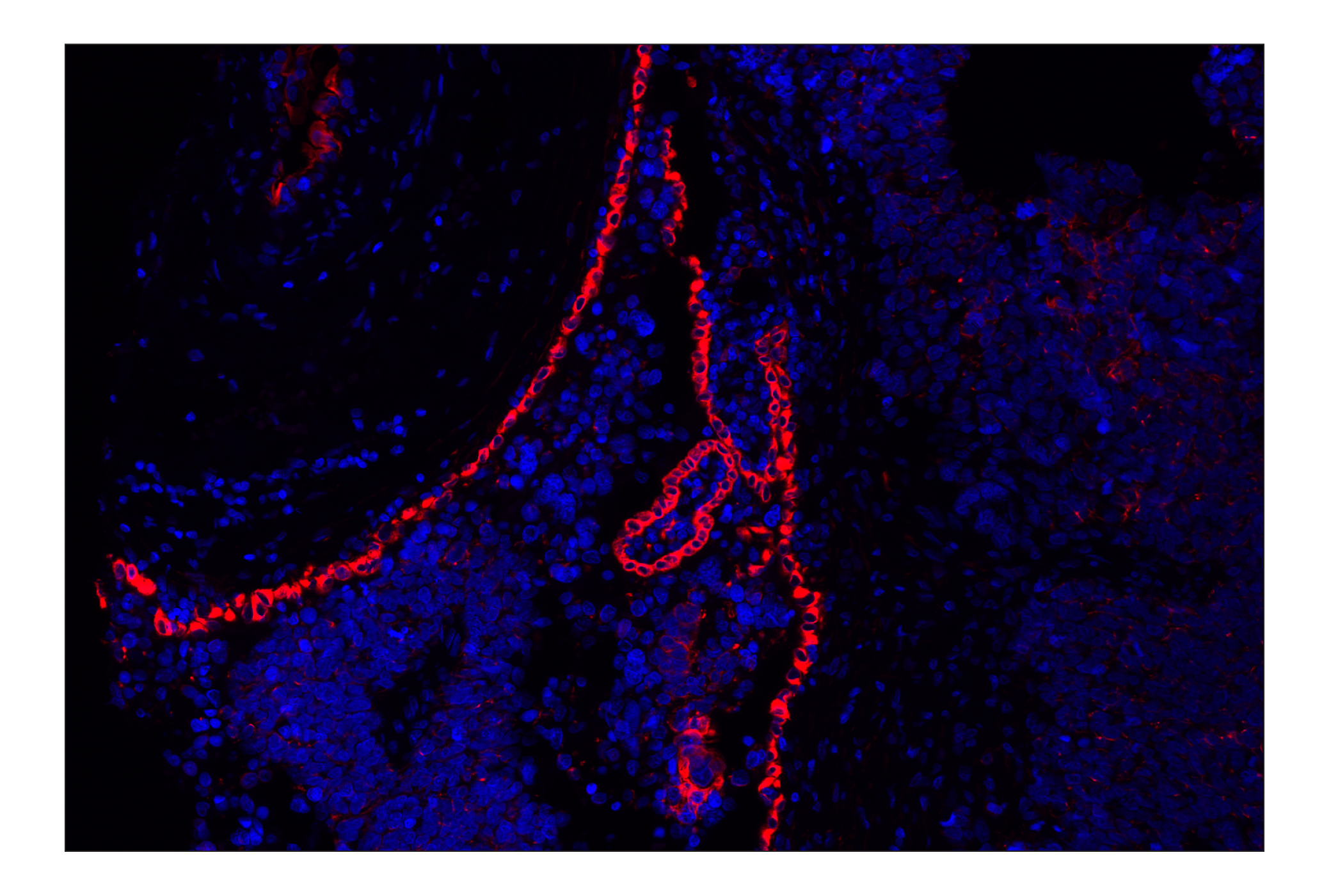 Immunohistochemistry Image 2: Keratin 8/18 (C51) Mouse mAb(Alexa Fluor® 555 Conjugate)