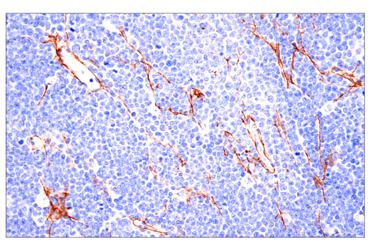 Immunohistochemistry Image 7: COL1A1 (E8F4L) XP® Rabbit mAb (BSA and Azide Free)