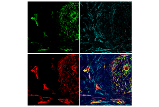 Immunofluorescence Image 1: COL1A1 (E8F4L) XP® Rabbit mAb (BSA and Azide Free)