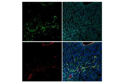 Immunofluorescence Image 2: COL1A1 (E8F4L) XP® Rabbit mAb (BSA and Azide Free)