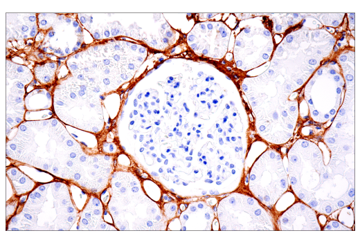 Immunohistochemistry Image 3: COL1A1 (E8F4L) XP® Rabbit mAb (BSA and Azide Free)