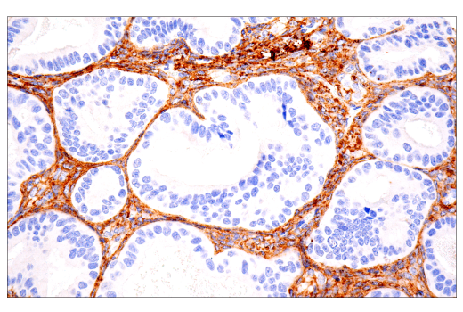 Immunohistochemistry Image 2: COL1A1 (E8F4L) XP® Rabbit mAb (BSA and Azide Free)