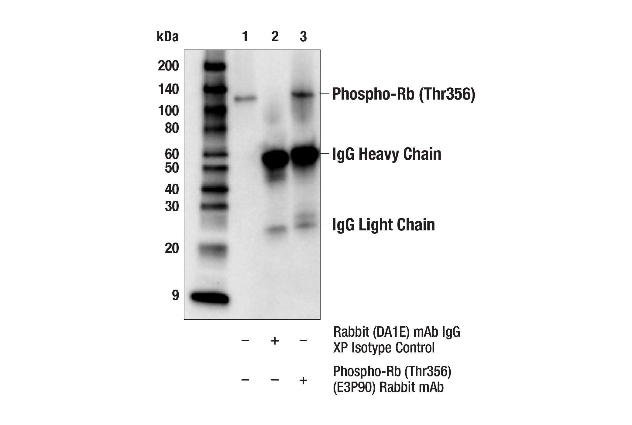 Immunoprecipitation Image 1: Phospho-Rb (Thr356) (E3P9O) Rabbit mAb