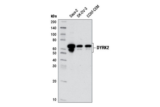 Western Blotting Image 1: DYRK2 Antibody