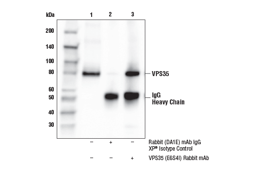 Immunoprecipitation Image 1: VPS35 (E6S4I) Rabbit mAb