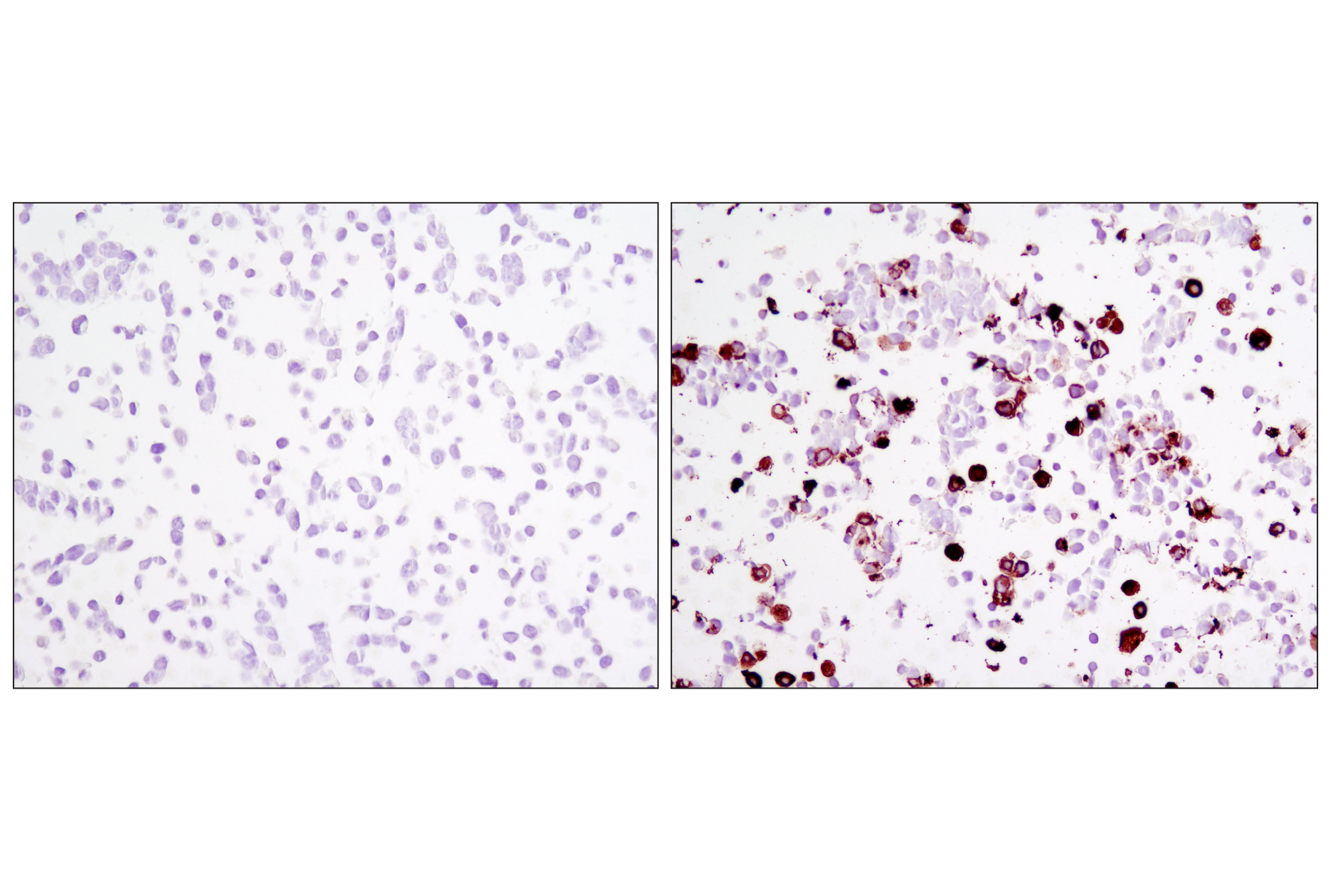 Immunohistochemistry Image 1: DYKDDDDK Tag (9A3) Mouse mAb (Binds to same epitope as Sigma-Aldrich Anti-FLAG M2 antibody)