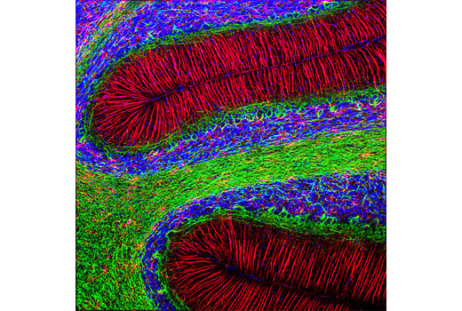 Immunofluorescence Image 1: GFAP (GA5) Mouse mAb (Alexa Fluor® 594 Conjugate)