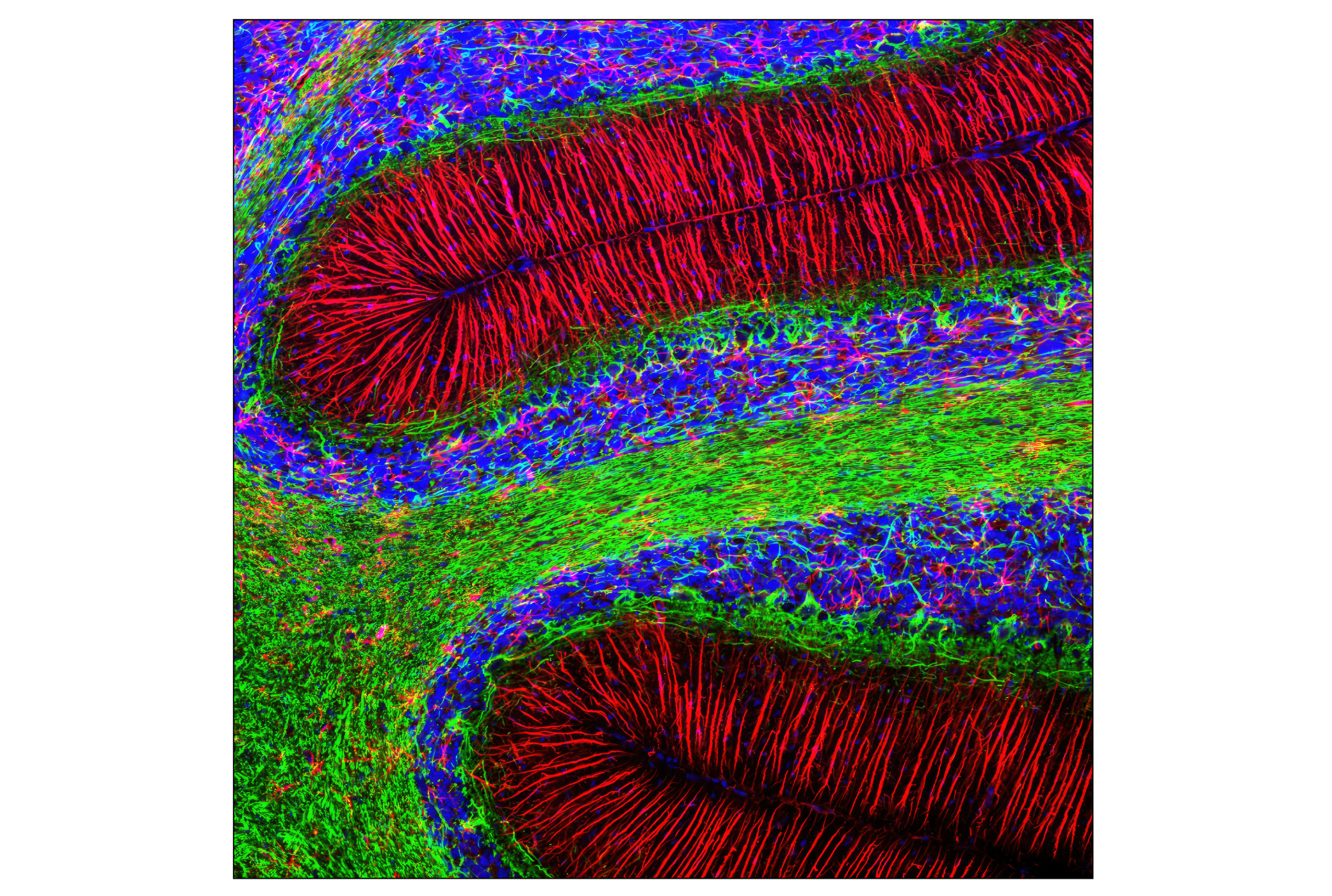 Immunofluorescence Image 1: GFAP (GA5) Mouse mAb (Alexa Fluor® 594 Conjugate)