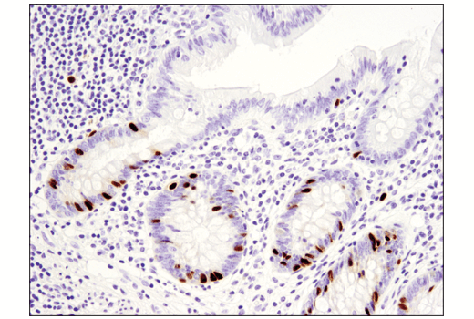 Immunohistochemistry Image 1: PAF15 (D8E2Y) XP® Rabbit mAb