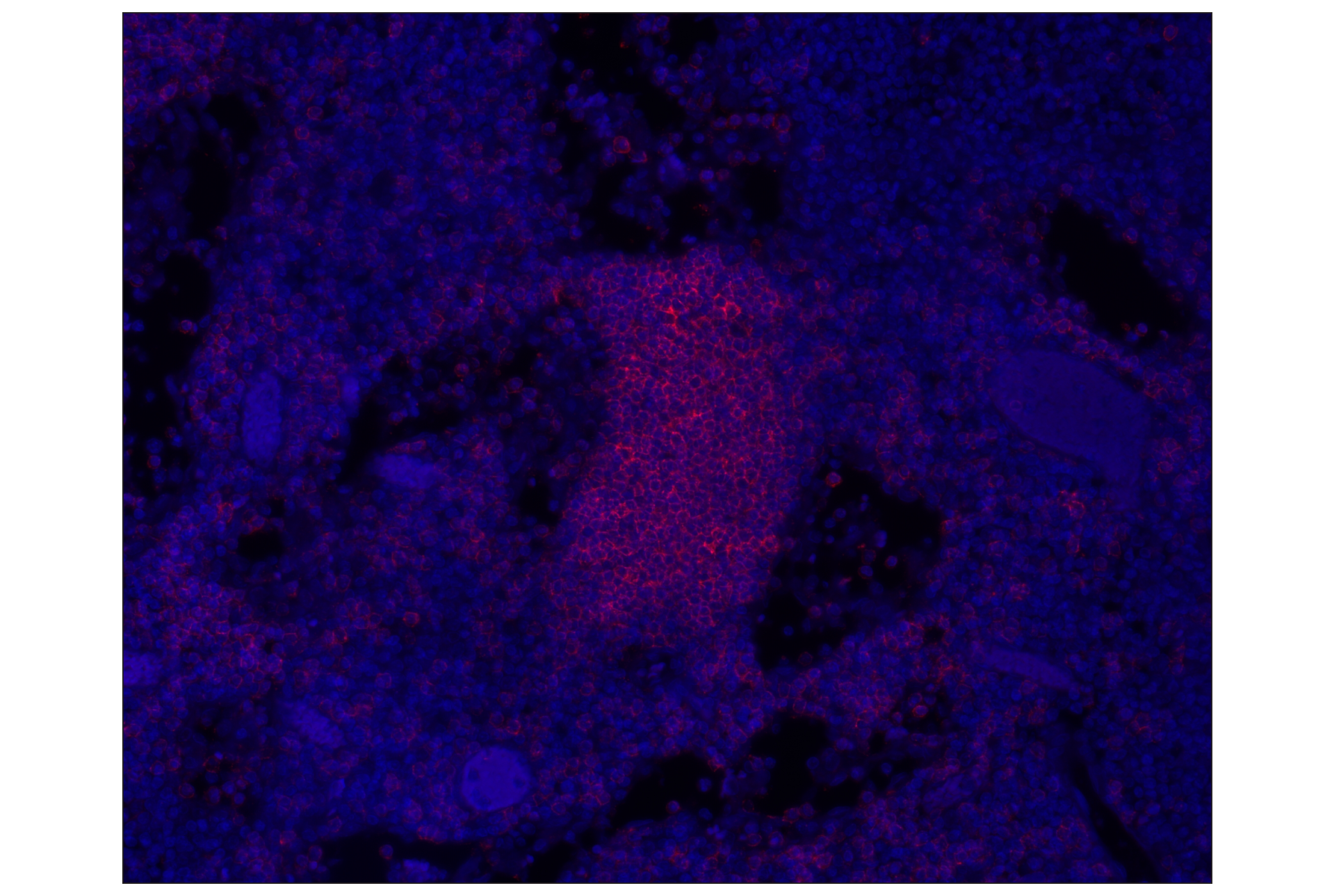 Immunohistochemistry Image 1: CD20 (E7B7T) XP® Rabbit mAb (Alexa Fluor® 555 Conjugate)