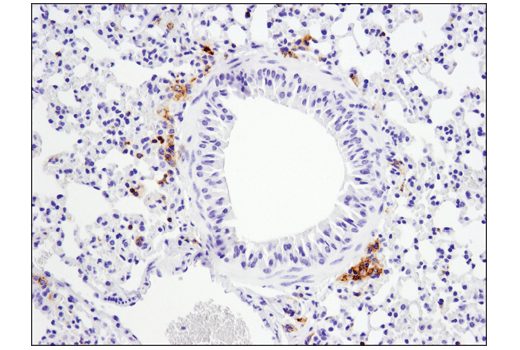 Immunohistochemistry Image 2: FcγRIIB (D8F9C) XP® Rabbit mAb (BSA and Azide Free)