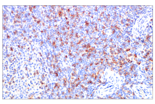 Immunohistochemistry Image 4: CD8α (D8A8Y) Rabbit mAb (BSA and Azide Free)