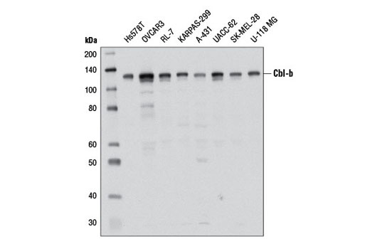 Western Blotting Image 1: Cbl-b Antibody