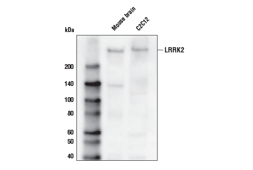 Western Blotting Image 1: LRRK2 (D18E12) Rabbit mAb (Biotinylated)