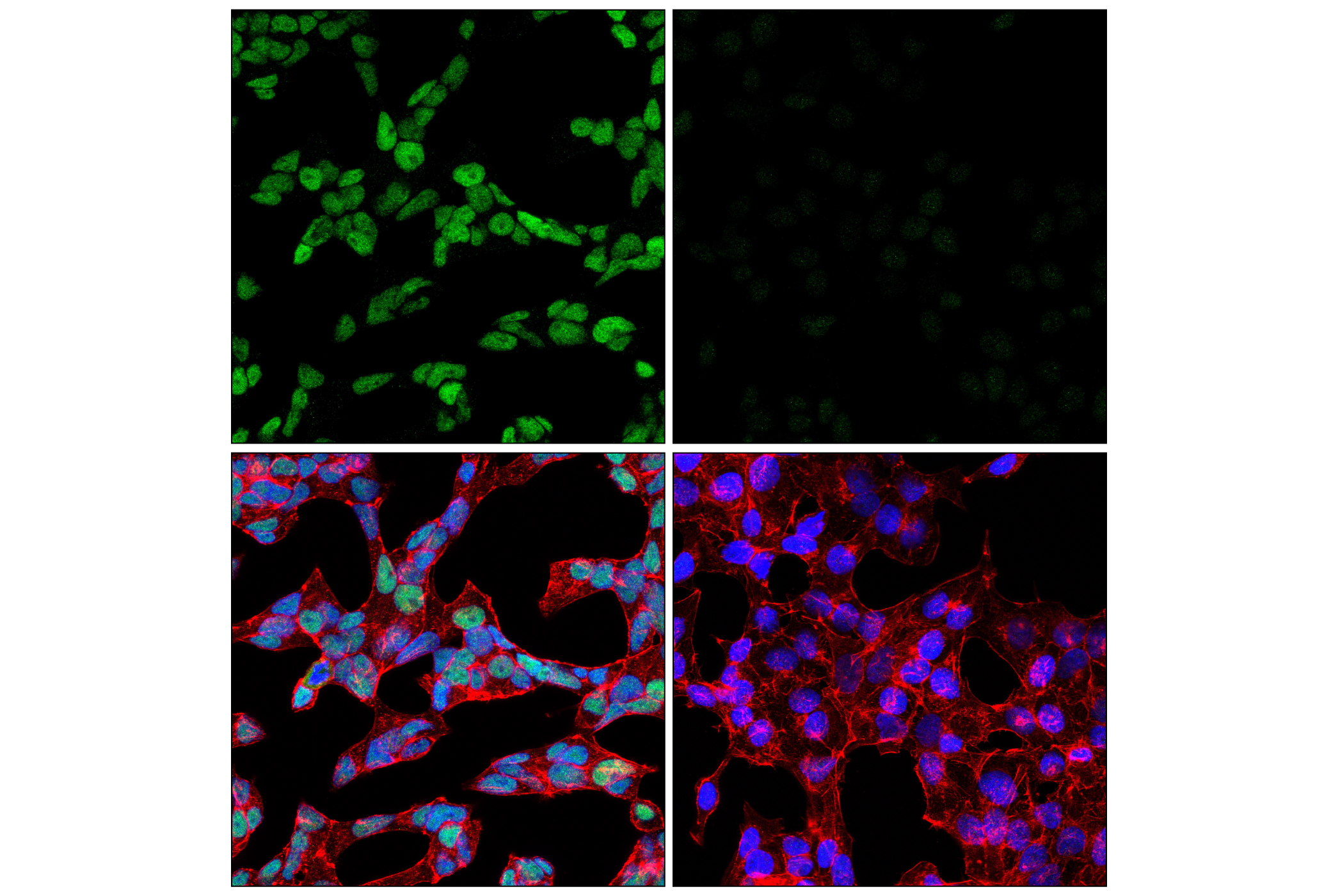 Immunofluorescence Image 1: CREST (E3P4F) Rabbit mAb