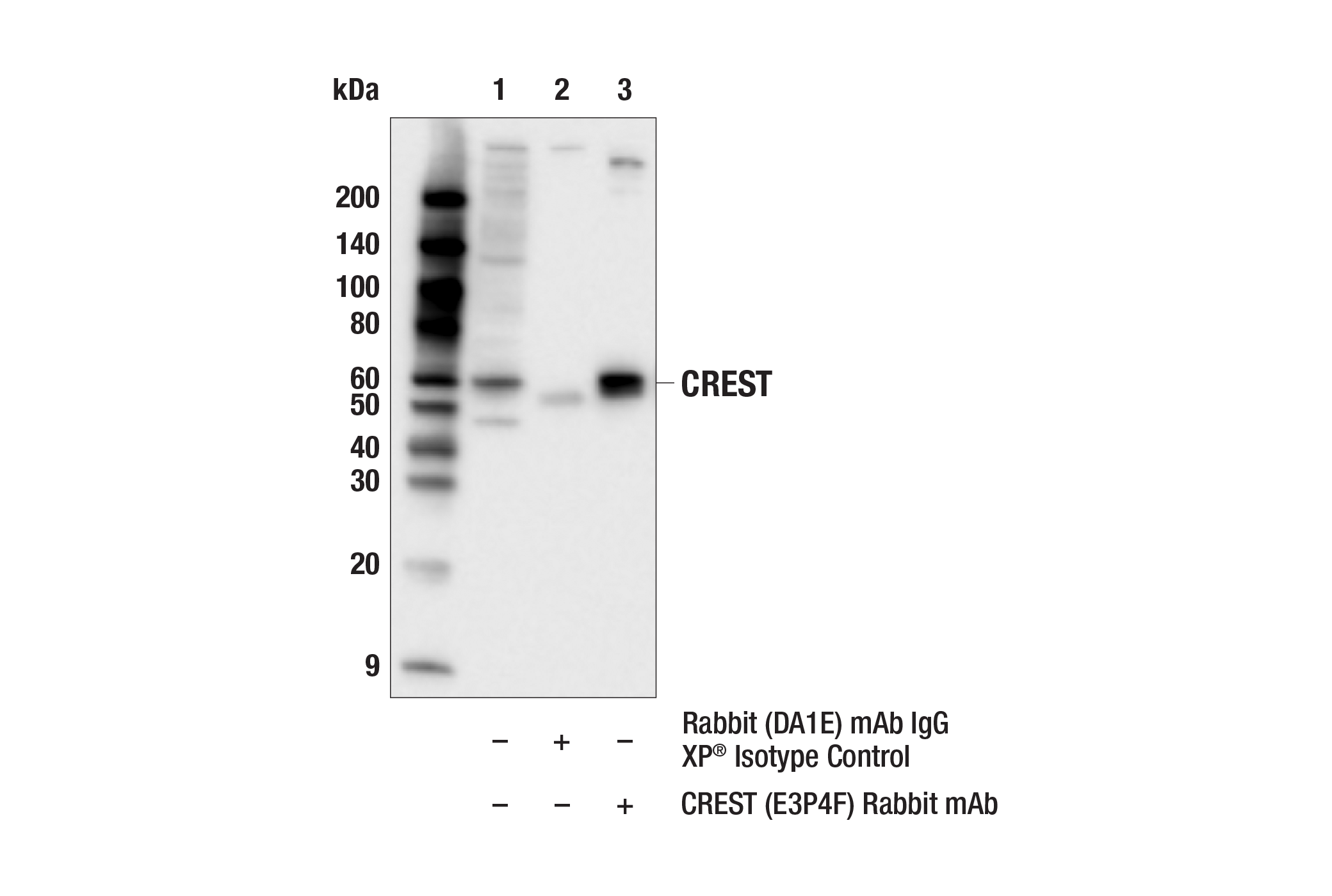 Immunoprecipitation Image 1: CREST (E3P4F) Rabbit mAb