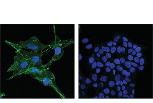 Immunofluorescence Image 1: N-Cadherin (D4R1H) XP® Rabbit mAb (Alexa Fluor® 488 Conjugate)