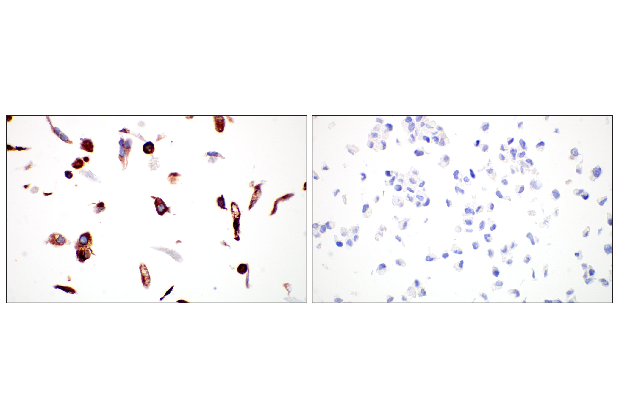 Immunohistochemistry Image 7: LPCAT1 (E4V4B) Rabbit mAb (BSA and Azide Free)