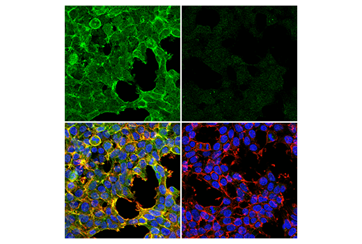 Immunofluorescence Image 1: MRCKα (E2S5I) Rabbit mAb