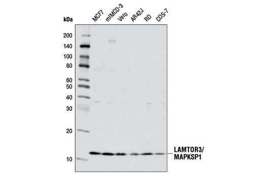 Western Blotting Image 1: LAMTOR3/MAPKSP1 (D38G5) Rabbit mAb