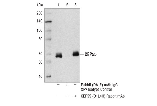 Immunoprecipitation Image 1: CEP55 (D1L4H) Rabbit mAb