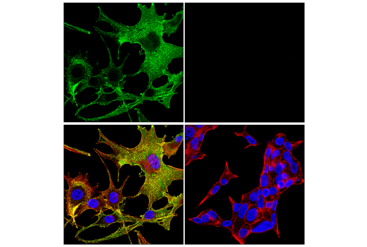 Immunofluorescence Image 1: MCAM (E3F3E) XP® Rabbit mAb