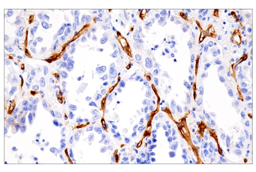 Immunohistochemistry Image 13: MCAM (E3F3E) XP® Rabbit mAb (BSA and Azide Free)