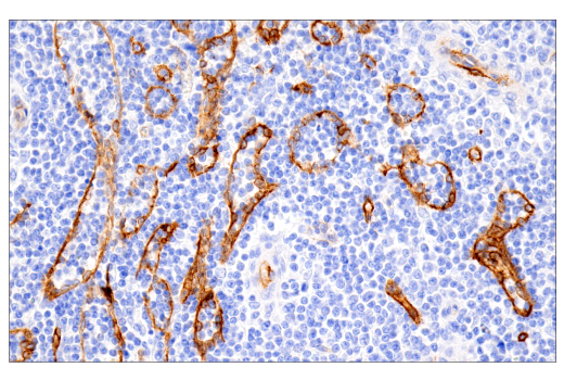 Immunohistochemistry Image 5: MCAM (E3F3E) XP® Rabbit mAb (BSA and Azide Free)