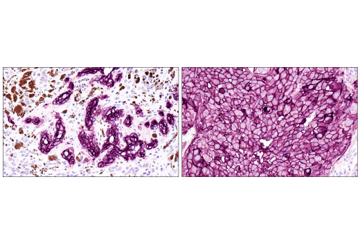 Immunohistochemistry Image 3: MCAM (E3F3E) XP® Rabbit mAb