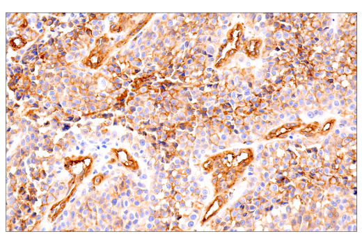 Immunohistochemistry Image 4: MCAM (E3F3E) XP® Rabbit mAb