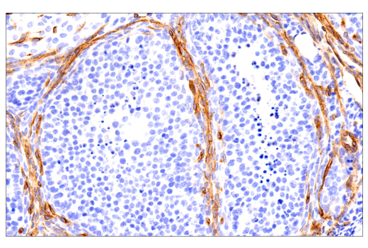 Immunohistochemistry Image 10: MCAM (E3F3E) XP® Rabbit mAb (BSA and Azide Free)