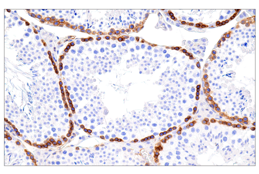 Immunohistochemistry Image 3: MCAM (E3F3E) XP® Rabbit mAb (BSA and Azide Free)