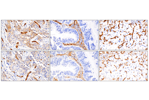 Immunohistochemistry Image 7: MCAM (E3F3E) XP® Rabbit mAb (BSA and Azide Free)