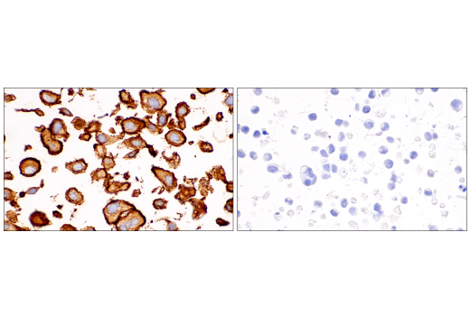 Immunohistochemistry Image 14: MCAM (E3F3E) XP® Rabbit mAb (BSA and Azide Free)