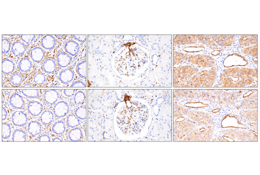 Immunohistochemistry Image 12: MCAM (E3F3E) XP® Rabbit mAb (BSA and Azide Free)