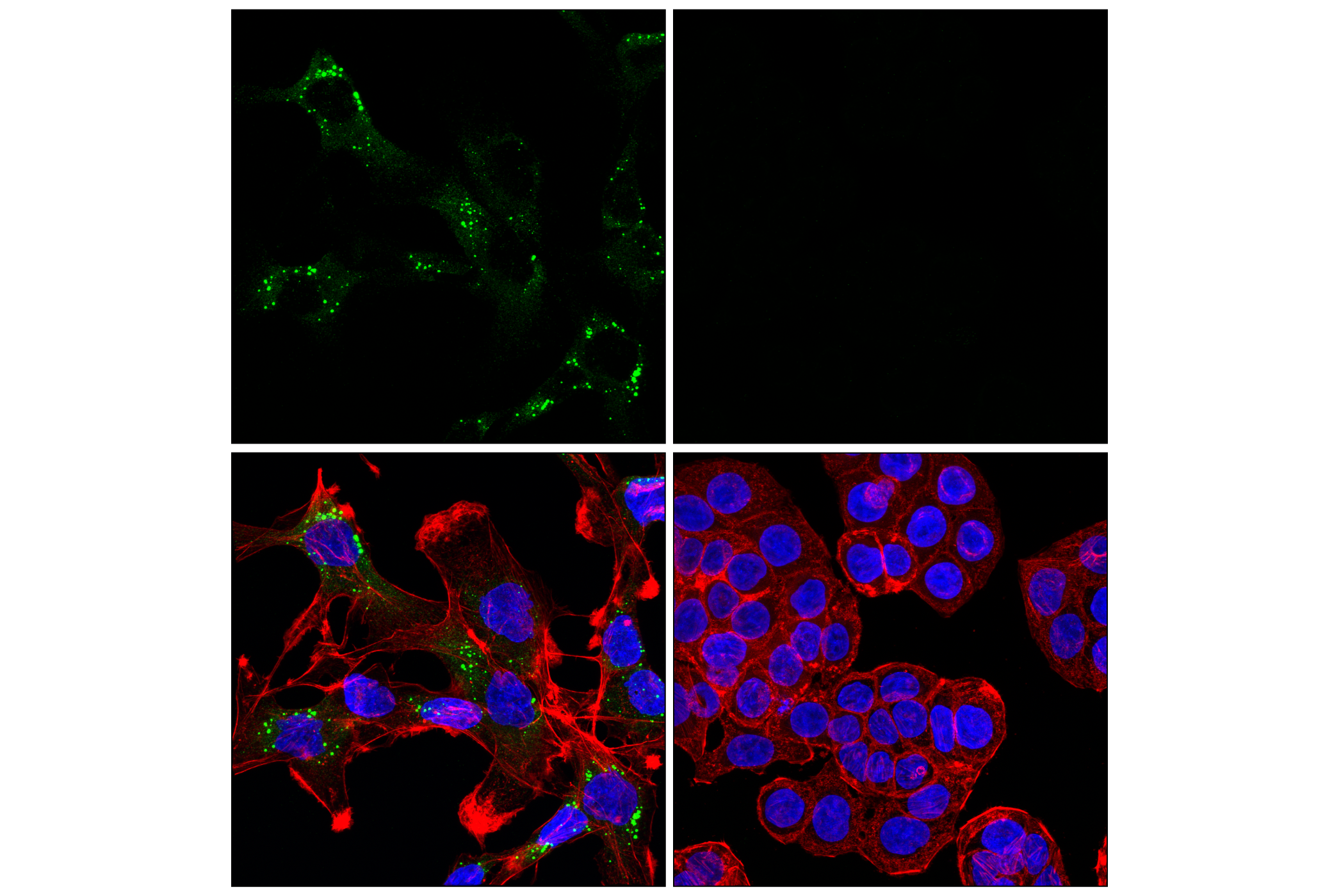 Immunofluorescence Image 1: COL7A1 (F4Q8A) Rabbit mAb