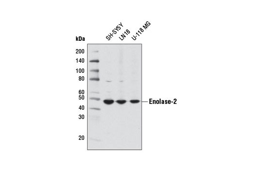 Western Blotting Image 1: Enolase-2 (D20H2) Rabbit mAb