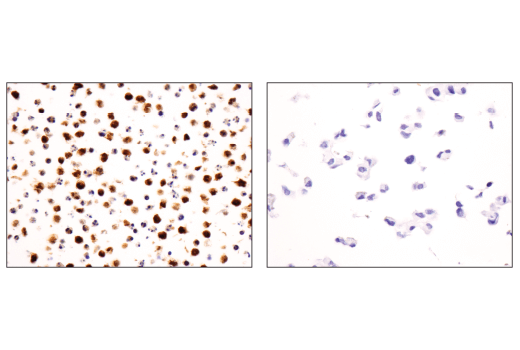 Immunohistochemistry Image 1: Syk (4D10) Mouse mAb (BSA and Azide Free)
